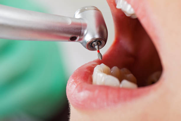 Best Emergency Cosmetic Dentistry in Old Fig Garden, CA